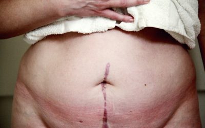 Six-Pack: Genética ou Esforço? A Verdade Sobre a Gordura Abdominal